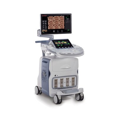 GE Voluson E6 Ultrasound Machine