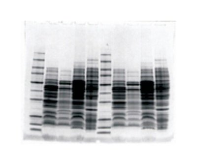 Thermo Fisher Owl™ P8DS Dual-Gel Vertical Electrophoresis Systems